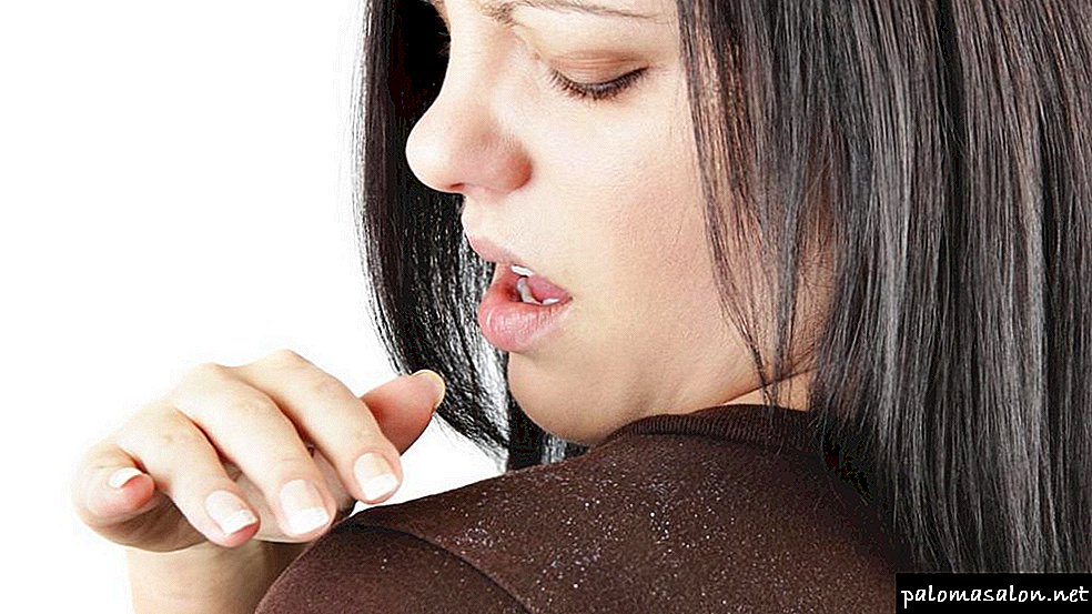 How to quickly cure dandruff? The best methods of getting rid of seborrhea