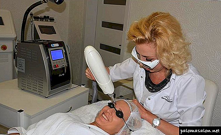 The advantages of laser eyebrow hair removal
