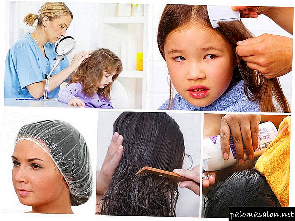Rules for the treatment of head lice and nits from pediculosis