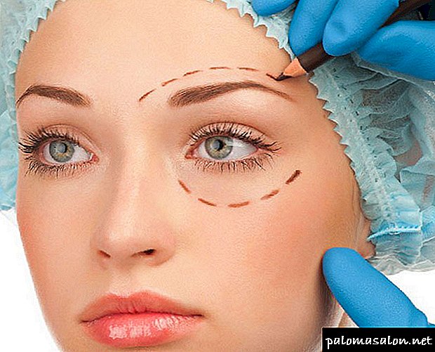 Endoscopic forehead and eyebrow lift - Before & After pictures, prices and effects Video
