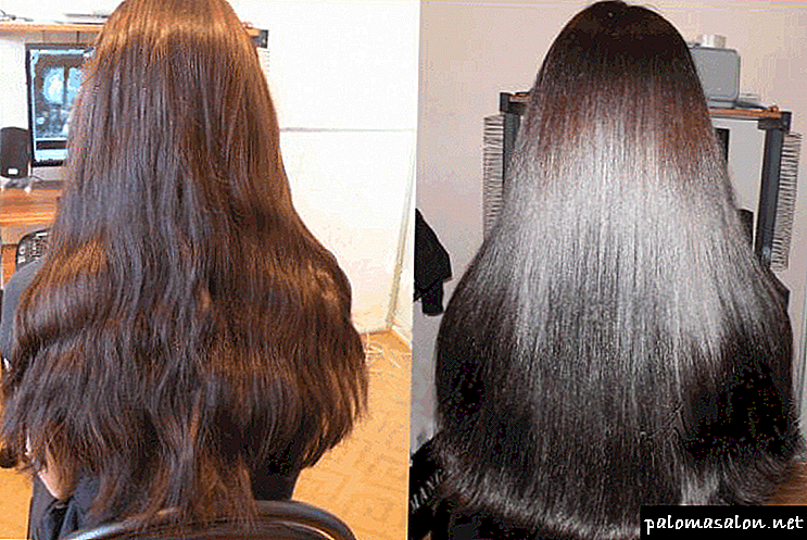 التدريع الشعر: وصف الإجراء ، الصورة قبل وبعد