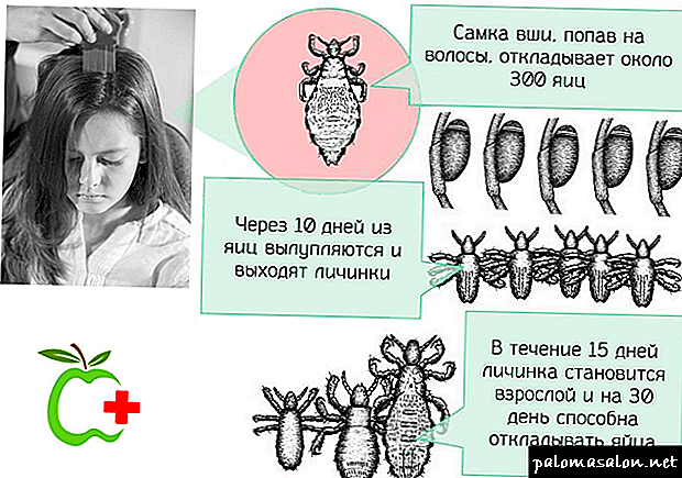 What natural remedies will help to completely get rid of lice