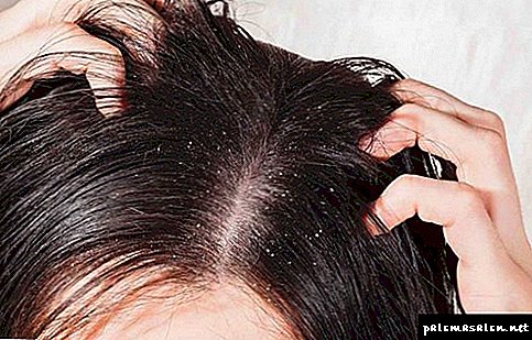 How to use kerosene for lice and nits