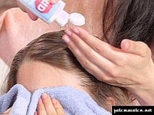 How to quickly get rid of lice with minimal effort