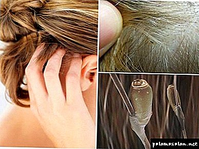 Dichlorvos for head lice: can I get it out?