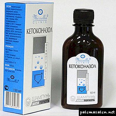 Como aplicar xampu caspa Ketoconazole? Prós e contras, eficácia, tratamento