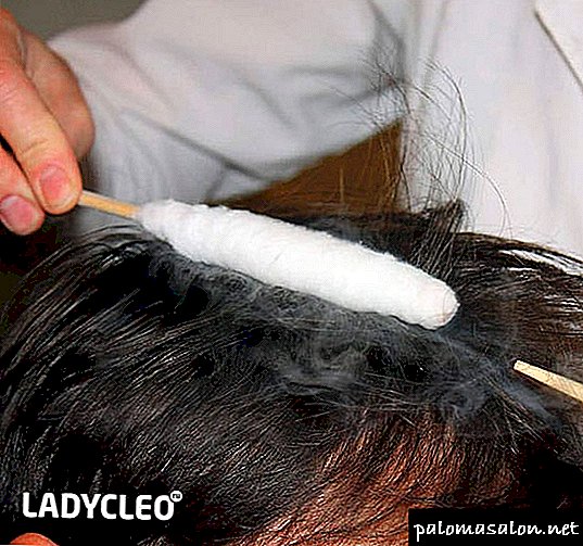 La crioterapia como tratamiento para el cuero cabelludo.