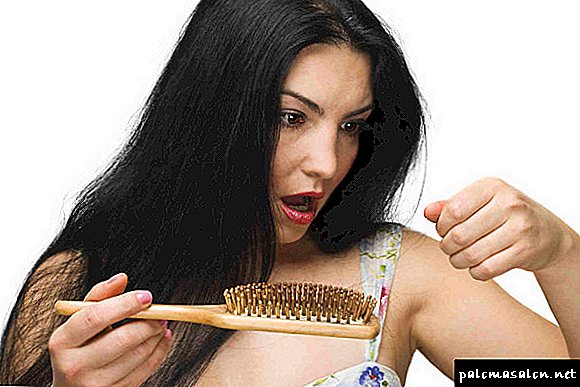هل من الممكن استعادة الشعر بعد الصلع: تجربة حقيقية