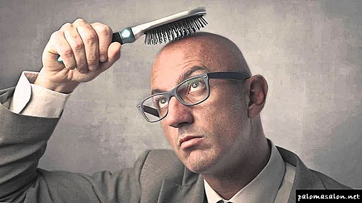 Hiustensiirto: kaikki mitä sinun tarvitsee tietää menettelystä