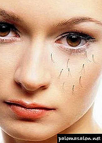 Ursachen für Wimpernverlust: Wir geben die frühere Schönheit zurück