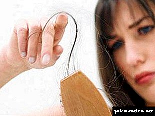 Baldness due to tight hair or traction alopecia