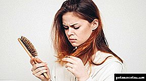 Causes de la perte de cheveux chez les filles