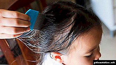 At what temperature do lice and nits die?