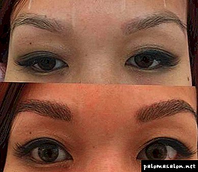 Eyebrow reconstruction or basic techniques 6d