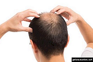Crecimiento y restauración del cabello con mesoterapia del cuero cabelludo.
