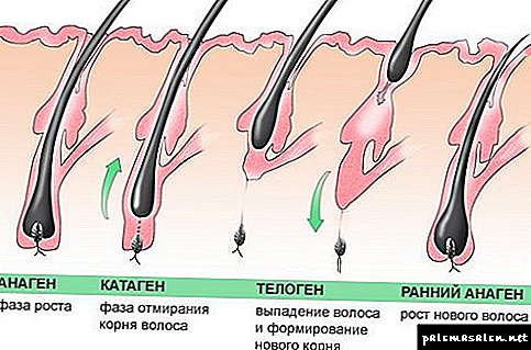 Maneiras eficazes de remover permanentemente os pêlos: uma revisão dos métodos