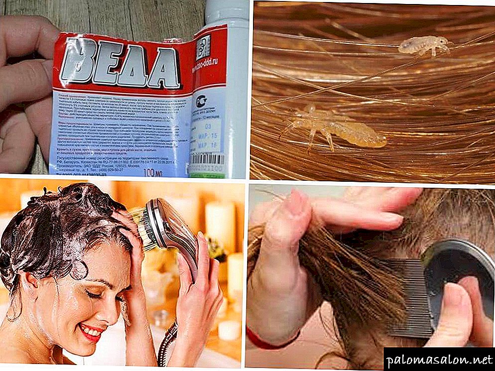 Shampoo Veda from lice and nits