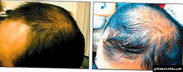 Problemas del cabello? Completamente - Remedio No. 1 para la restauración del cabello.