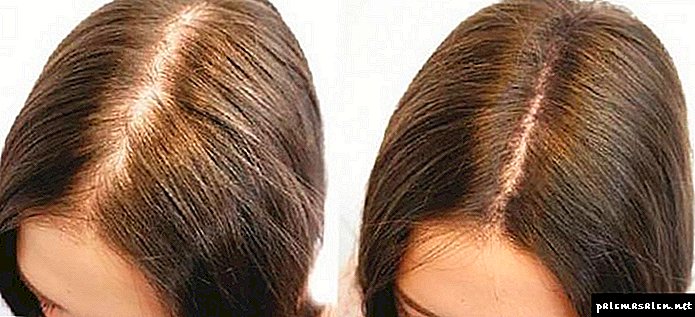 Vitamine gegen Haarausfall in Ampullen