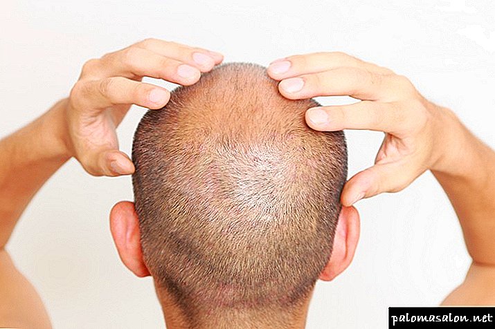 Visibly lose hair? Urgently hand over analyzes!